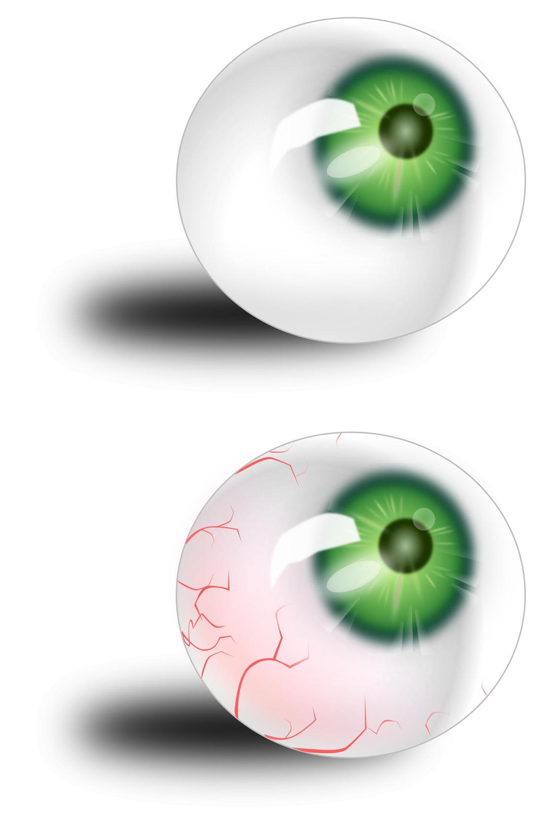 Eyeball green & bloodshot png transparent