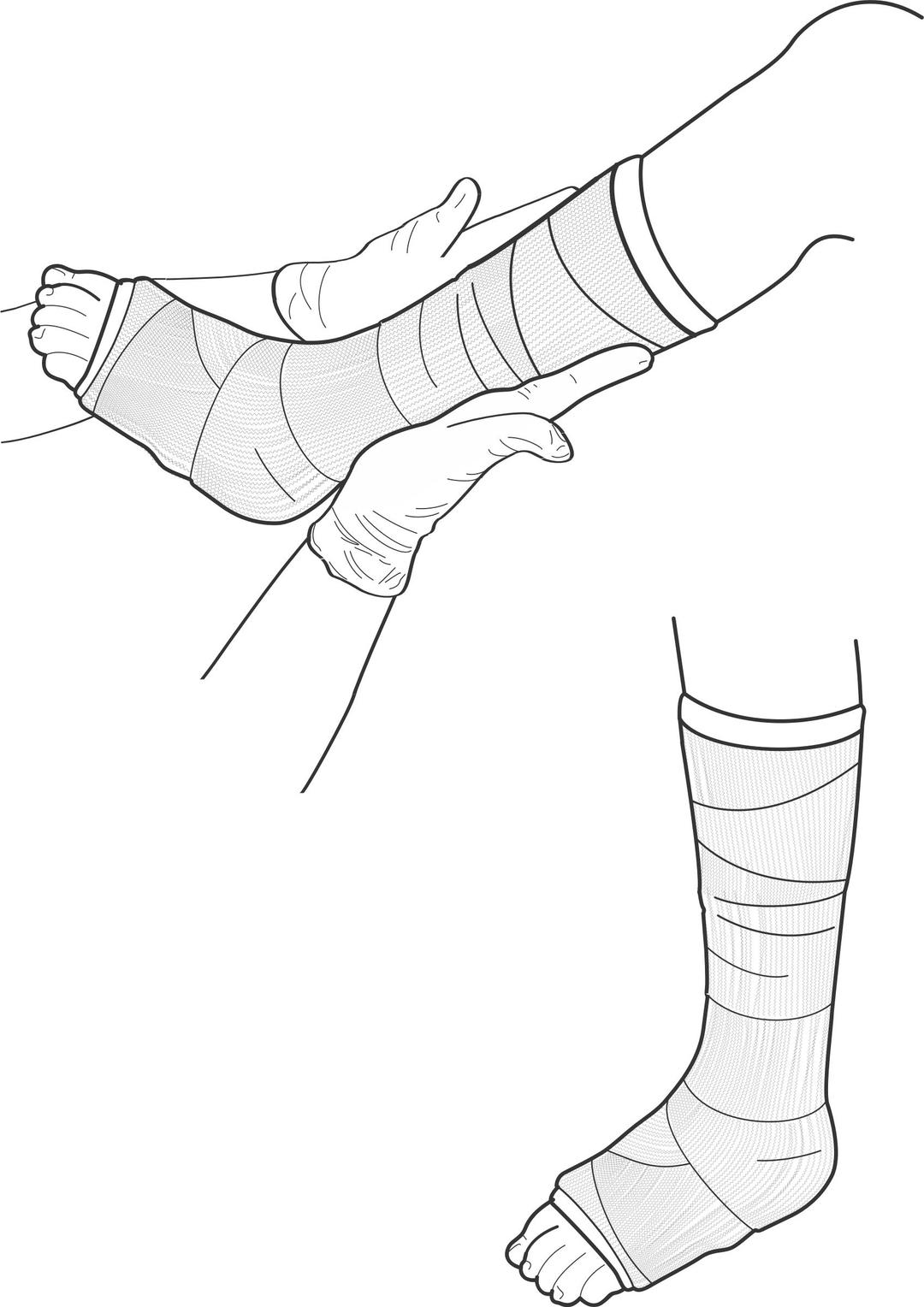 Leg Cast png transparent