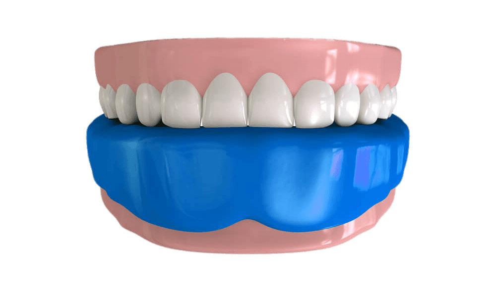 Mouthguard on Lower Teeth Illustration png transparent