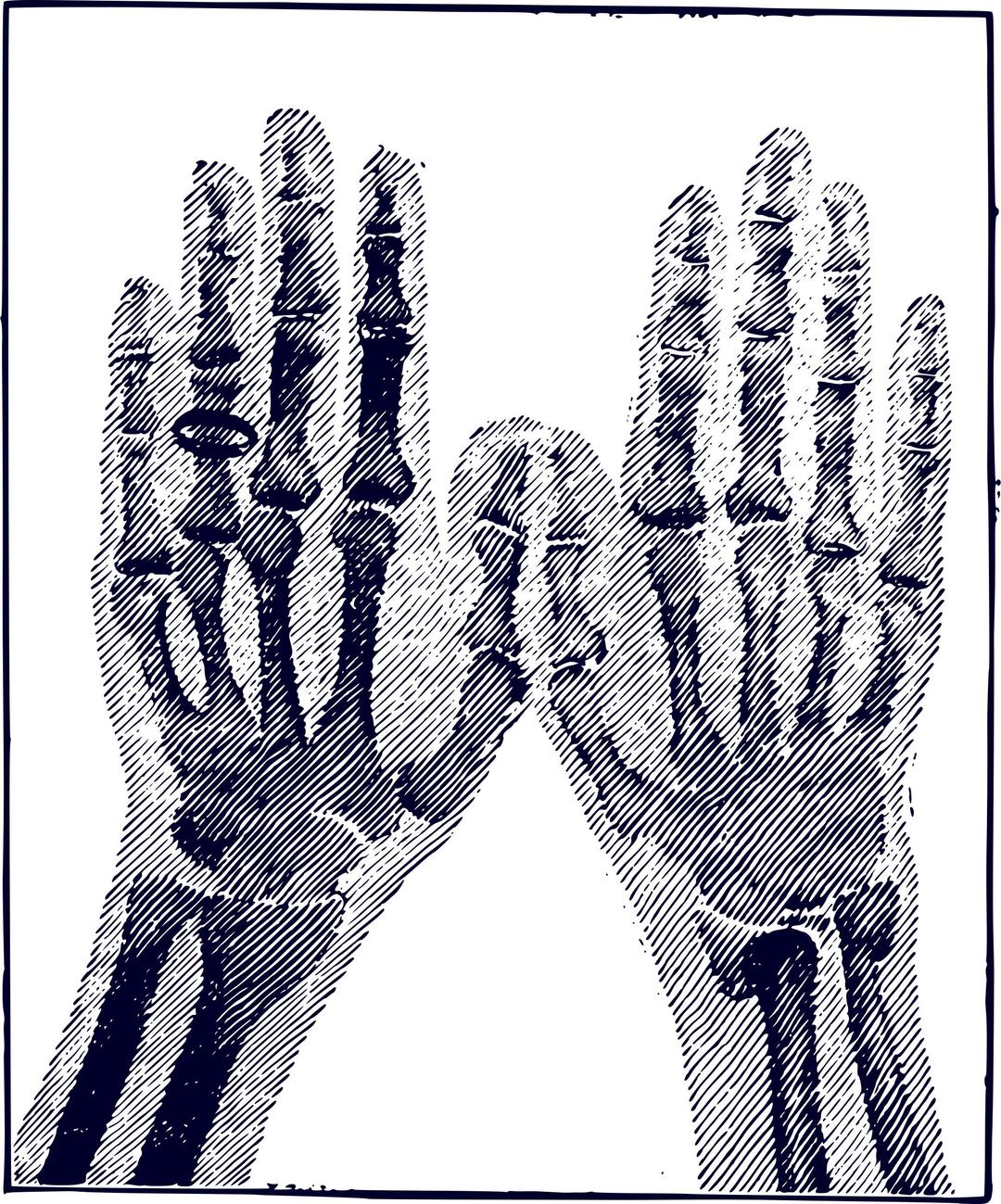 X-ray Image png transparent
